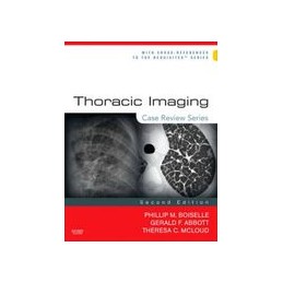 Thoracic Imaging: Case Review Series
