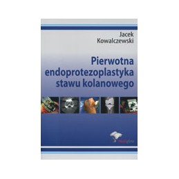 Pierwotna endoprotezoplastyka stawu kolanowego