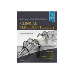 Newman and Carranza's Clinical Periodontology