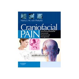 Craniofacial Pain