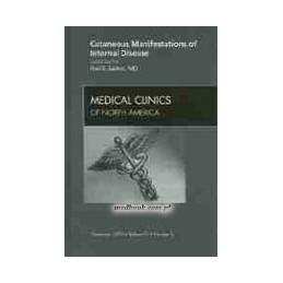 Cutaneous Manifestations of Internal Disease, An Issue of Medical Clinics
