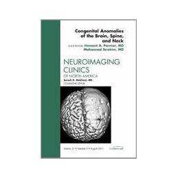 Congenital Anomalies of the Brain, Spine, and Neck, An Issue of Neuroimaging Clinics