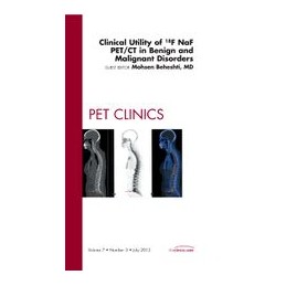 Clinical Utility of 18NaF PET/CT in Benign and Malignant Disorders, An Issue of PET Clinics