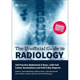 Unofficial Guide to Radiology: 100 Practice Abdominal X Rays with Full Colour Annotations and Full X Ray Reports