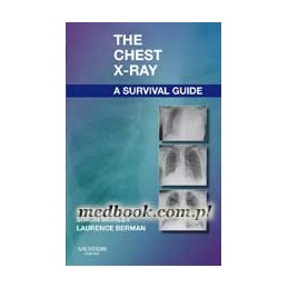 The Chest X-Ray: A Survival...