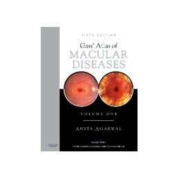 Gass' Atlas of Macular Diseases