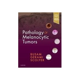 Pathology of Melanocytic...