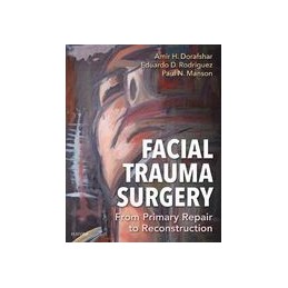 Facial Trauma Surgery