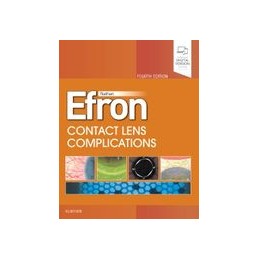 Contact Lens  Complications