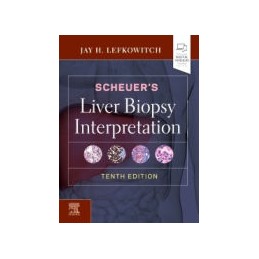 Scheuer's Liver Biopsy...