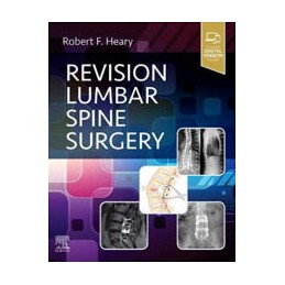 Revision Lumbar Spine Surgery