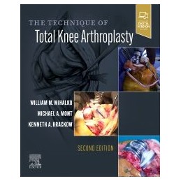The Technique of Total Knee Arthroplasty