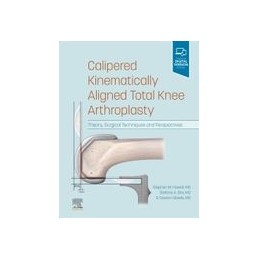Calipered Kinematically aligned Total Knee Arthroplasty