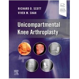 Unicompartmental Knee...