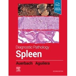 Diagnostic Pathology: Spleen