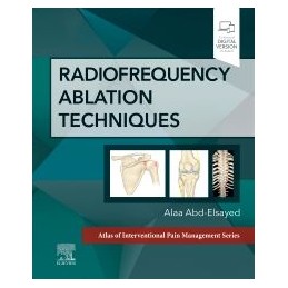 Radiofrequency Ablation...