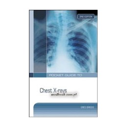 Pocket Guide to Chest X-Rays