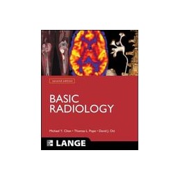 Basic Radiology, Second...