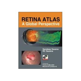 Retina Atlas: A Global...