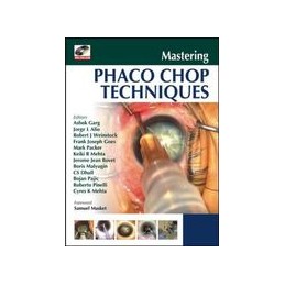 Mastering Phaco Chop...
