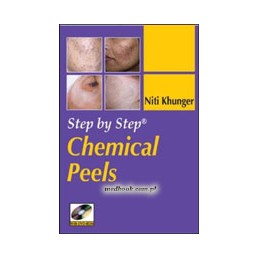 Step by Step Chemical Peels