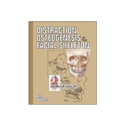 Distraction Osteogenesis of...