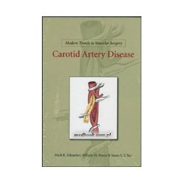 Modern Trends in Vascular Surgery: Carotid Artery Disease