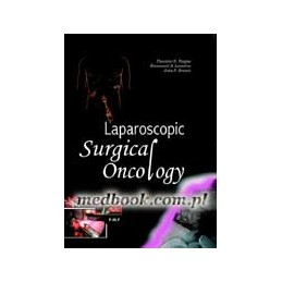 Laparoscopic Surgical Oncology