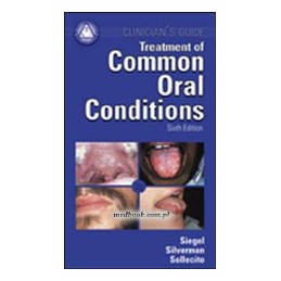 Treatment Common Oral Conditions