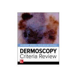 Dermoscopy  Criteria Review