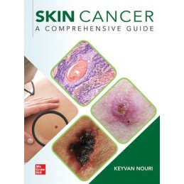Skin Cancer: A...
