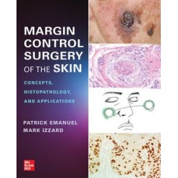 Margin Control Surgery of...