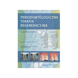 Periodontologiczna terapia regeneracyjna