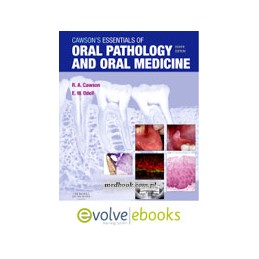 Cawson's Essentials of Oral Pathology and Oral Medicine Text and Evolve eBooks Package