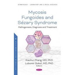 Mycosis Fungoides and Sezary Syndrome: Pathogenesis, Diagnosis and Treatment