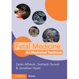 Fetal Medicine: An...