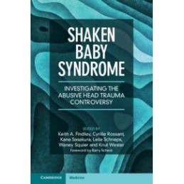 Shaken Baby Syndrome: Investigating the Abusive Head Trauma Controversy