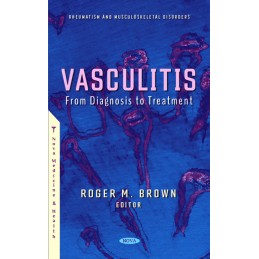 Vasculitis: From Diagnosis...