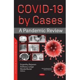 COVID-19 by Cases: A Pandemic Review