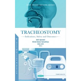 Tracheostomy: Indications,...