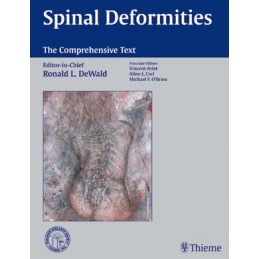 Spinal Deformities: The...