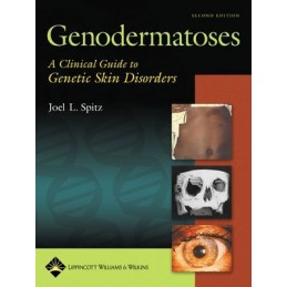 Genodermatoses: A Clinical Guide to Genetic Skin Disorders