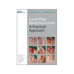 Local Flap Reconstruction