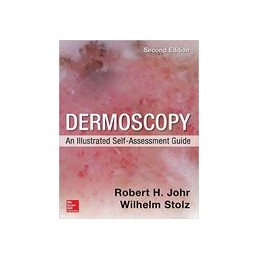 Dermoscopy: An Illustrated...