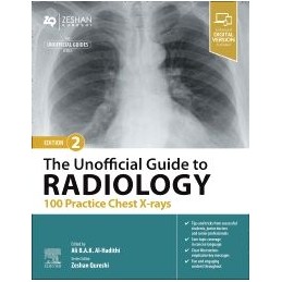 The Unofficial Guide to Radiology: 100 Practice Chest X-rays