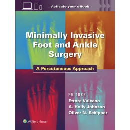 Minimally Invasive Foot and...