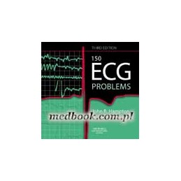 150 ECG Problems