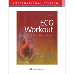 ECG Workout: Exercises in Arrythmia Interpretation