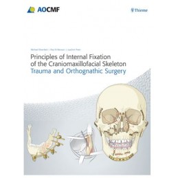 Principles of Internal Fixation of the Craniomaxillofacial Skeleton: Trauma and Orthognathic Surgery