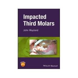 Impacted Third Molars